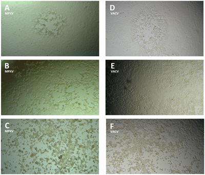 Evaluation of Monkeypox- and Vaccinia virus-neutralizing antibodies in human serum samples after vaccination and natural infection